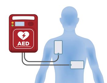 Predstavitev delovanja  avtomatskega eksternega defibrilatorja (AED)