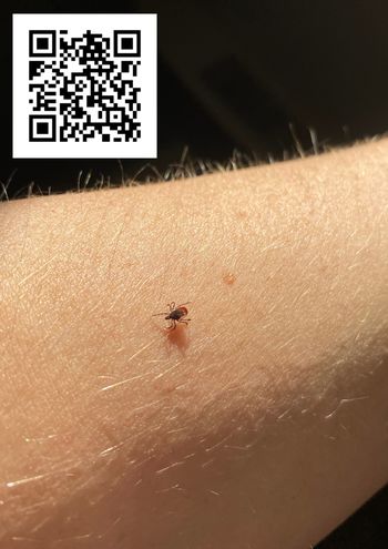 Zaskrbljujoča rast bolezni, ki jih prenašajo klopi v Gorenjski regiji Zaskrbljujoča rast bolezni, ki jih prenašajo klopi v Gorenjski regiji