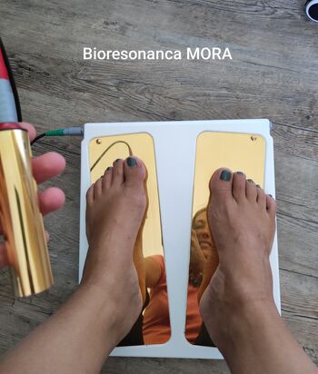 KAJ JE BIORESONANCA (MORA)? KAJ JE BIORESONANCA (MORA)?