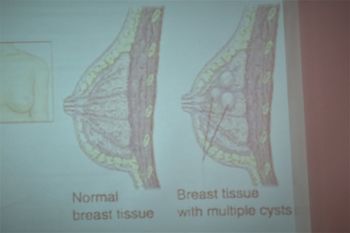 Srečanje članov ILCO društva