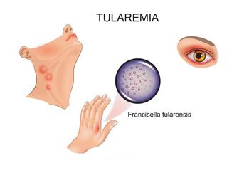Zajčja mrzlica tudi na Goriškem