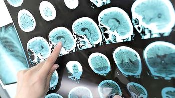 Svetovni dan multiple skleroze v Novem mestu Svetovni dan multiple skleroze v Novem mestu