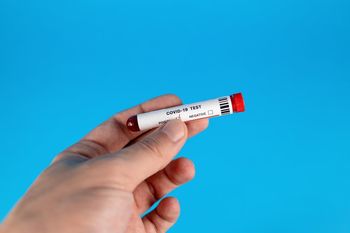 Od 18. marca dalje nov urnik brezplačnega testiranja na kontrolnih točkah z Italijo Od 18. marca dalje nov urnik brezplačnega testiranja na kontrolnih točkah z Italijo