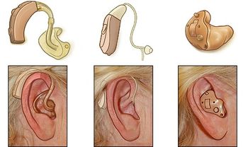  Predavanje o problematiki okvare sluha