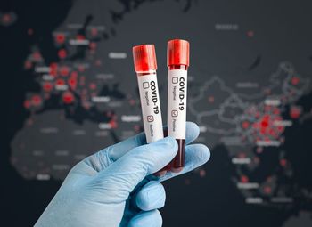 NIJZ objavil navodila za osebe s potrjeno okužbo in vse, ki so ji bili izpostavljeni