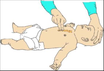 Ali znate oživljati?