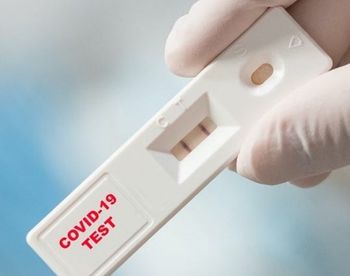 Obvestilo ZD Domžale o množičnem presejalnem testiranju SARS CoV-2