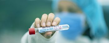 OBVESTILO - Množično presejalno testiranje SARS-Cov-2 s hitrimi antigenskimi testi za občane Ivančne Gorice