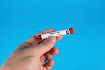 Javna obravnava in zbiranje pripomb - Delni načrt zaščite in reševanja ob pojavu epidemije oziroma pandemije nalezljive bolezni pri ljudeh za občino Bohinj